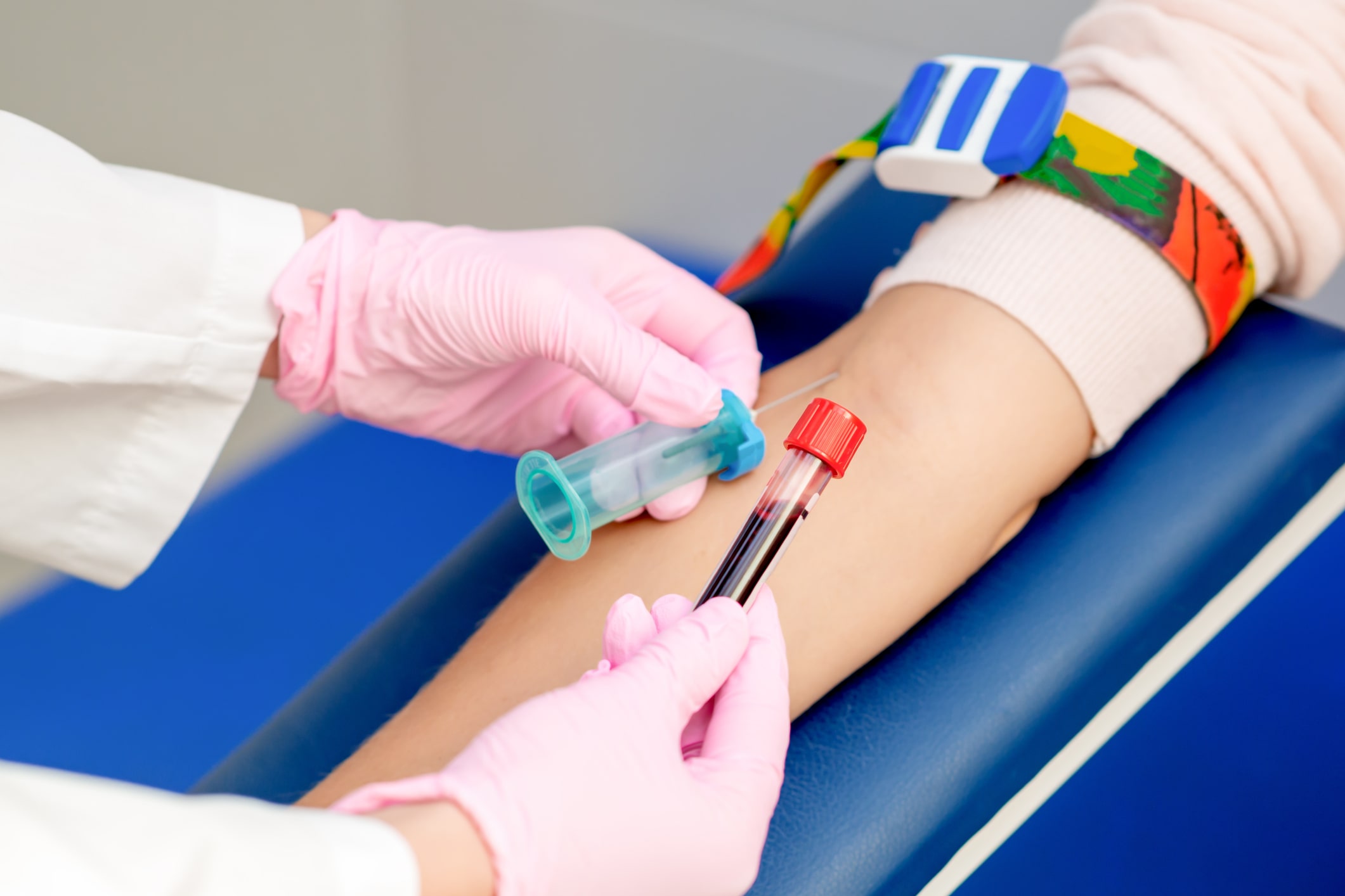 Ein Mitarbeiter des Gesundheitswesens mit rosa Handschuhen entnimmt für eine Eigenbluttherapie mithilfe einer Spritze und eines Röhrchens mit roter Kappe eine Blutprobe aus dem Arm eines Patienten.