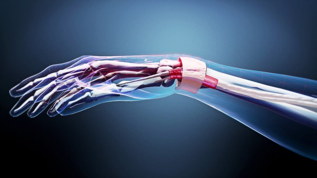 Digitale Illustration einer menschlichen Hand und eines Unterarms mit Knochen, Sehnen und Blutgefäßen durch eine halbtransparente Schicht, die die für die Tendovaginitis De Quervain relevanten anatomischen Merkmale hervorhebt.