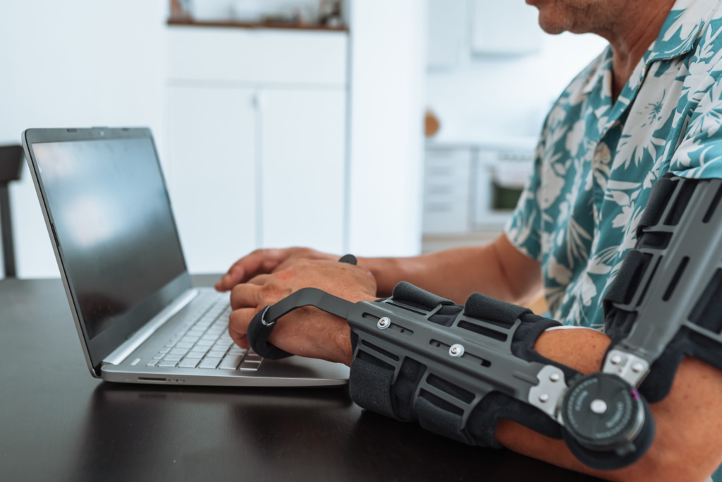 Seitenbandruptur am Ellbogen Eine Person mit einem Enchondrom trägt eine medizinische Armschiene, während sie an einem Tisch in einer modernen, hellen Küche auf einem Laptop tippt.